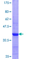 CPNE4 Protein - 12.5% SDS-PAGE Stained with Coomassie Blue.
