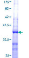 CPOX Protein - 12.5% SDS-PAGE Stained with Coomassie Blue.