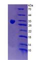 CR1 / CD35 Protein - Recombinant Complement Receptor 1, Erythrocyte By SDS-PAGE