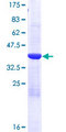 CRBPIV / RBP7 Protein - 12.5% SDS-PAGE of human RBP7 stained with Coomassie Blue