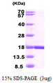 CRBPIV / RBP7 Protein