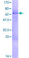 CRD / CRX Protein - 12.5% SDS-PAGE of human CRX stained with Coomassie Blue