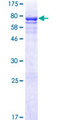 CRLF3 Protein - 12.5% SDS-PAGE of human CRLF3 stained with Coomassie Blue