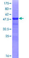 CRYBA1 Protein - 12.5% SDS-PAGE of human CRYBA1 stained with Coomassie Blue