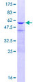 CRYBB3 Protein - 12.5% SDS-PAGE of human CRYBB3 stained with Coomassie Blue