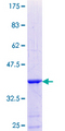 CRYBB3 Protein - 12.5% SDS-PAGE Stained with Coomassie Blue.