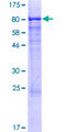 CSGALNACT2 Protein - 12.5% SDS-PAGE of human GALNACT-2 stained with Coomassie Blue