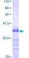 CSNK1G1 / CKI-Gamma 1 Protein - 12.5% SDS-PAGE Stained with Coomassie Blue.