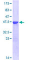 CSRP1 Protein - 12.5% SDS-PAGE of human CSRP1 stained with Coomassie Blue