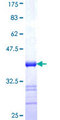 CSRP1 Protein - 12.5% SDS-PAGE Stained with Coomassie Blue.