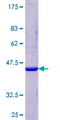 CST5 Protein - 12.5% SDS-PAGE of human CST5 stained with Coomassie Blue