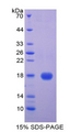 CST5 Protein - Recombinant Cystatin 5 By SDS-PAGE