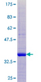 CST8 / CRES Protein - 12.5% SDS-PAGE of human CST8 stained with Coomassie Blue