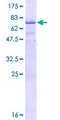 CT47A11 Protein - 12.5% SDS-PAGE of human RP6-166C19.11 stained with Coomassie Blue