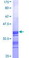 CTB / PCYT1B Protein - 12.5% SDS-PAGE Stained with Coomassie Blue.