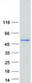 CTB / PCYT1B Protein - Purified recombinant protein PCYT1B was analyzed by SDS-PAGE gel and Coomassie Blue Staining