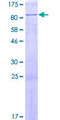 CTDSPL2 Protein - 12.5% SDS-PAGE of human CTDSPL2 stained with Coomassie Blue