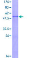 CTRB1 / Chymotrypsinogen B1 Protein - 12.5% SDS-PAGE of human CTRB1 stained with Coomassie Blue