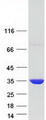 CUTC Protein - Purified recombinant protein CUTC was analyzed by SDS-PAGE gel and Coomassie Blue Staining