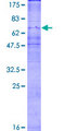 CX3CR1 Protein - 12.5% SDS-PAGE of human CX3CR1 stained with Coomassie Blue
