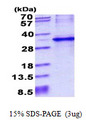 CYB5R1 Protein