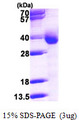 CYB5R3 / B5R Protein