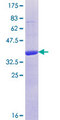 CYLC1 Protein - 12.5% SDS-PAGE Stained with Coomassie Blue.