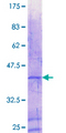 CYLC2 Protein - 12.5% SDS-PAGE Stained with Coomassie Blue.