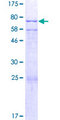 CYP-M / CYP20A1 Protein - 12.5% SDS-PAGE of human CYP20A1 stained with Coomassie Blue