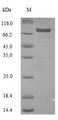 CYP17 / CYP17A1 Protein - (Tris-Glycine gel) Discontinuous SDS-PAGE (reduced) with 5% enrichment gel and 15% separation gel.