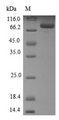 CYP21A2 Protein - (Tris-Glycine gel) Discontinuous SDS-PAGE (reduced) with 5% enrichment gel and 15% separation gel.