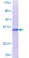 CYP2U1 Protein - 12.5% SDS-PAGE of human CYP2U1 stained with Coomassie Blue