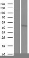 CYP3A43 Protein - Western validation with an anti-DDK antibody * L: Control HEK293 lysate R: Over-expression lysate