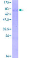 CYP3A7 Protein - 12.5% SDS-PAGE of human CYP3A7 stained with Coomassie Blue