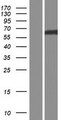 CYPIVA22 / CYP4A22 Protein - Western validation with an anti-DDK antibody * L: Control HEK293 lysate R: Over-expression lysate