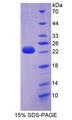 D2HGDH Protein - Recombinant D2-Hydroxyglutarate Dehydrogenase By SDS-PAGE
