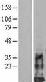 DAP10 Protein - Western validation with an anti-DDK antibody * L: Control HEK293 lysate R: Over-expression lysate