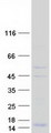 DAP10 Protein - Purified recombinant protein HCST was analyzed by SDS-PAGE gel and Coomassie Blue Staining