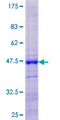 DBF4B / DRF1 Protein - 12.5% SDS-PAGE of human DRF1 stained with Coomassie Blue