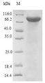 DBH/Dopamine Beta Hydroxylase Protein - (Tris-Glycine gel) Discontinuous SDS-PAGE (reduced) with 5% enrichment gel and 15% separation gel.