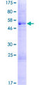 DCANP1 Protein - 12.5% SDS-PAGE of human C5orf20 stained with Coomassie Blue