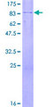 DCDC2 Protein - 12.5% SDS-PAGE of human DCDC2 stained with Coomassie Blue