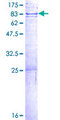 DCLRE1B Protein - 12.5% SDS-PAGE of human DCLRE1B stained with Coomassie Blue