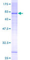 DCLRE1C / Artemis Protein - 12.5% SDS-PAGE of human DCLRE1C stained with Coomassie Blue