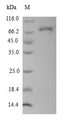 DCT / Dopachrome Tautomerase Protein - (Tris-Glycine gel) Discontinuous SDS-PAGE (reduced) with 5% enrichment gel and 15% separation gel.