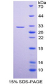 DCT / Dopachrome Tautomerase Protein - Recombinant  Dopachrome Tautomerase By SDS-PAGE