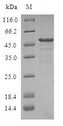 DCTD / dCMP Deaminase Protein - (Tris-Glycine gel) Discontinuous SDS-PAGE (reduced) with 5% enrichment gel and 15% separation gel.