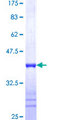 DCTD / dCMP Deaminase Protein - 12.5% SDS-PAGE Stained with Coomassie Blue.