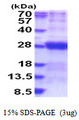 DCTN6 / Dynactin 6 Protein