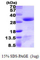 DCUN1D1 / SCCRO Protein